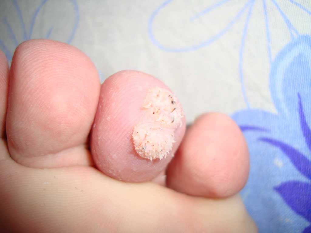 Что это за болезнь? - DSC00181.jpg