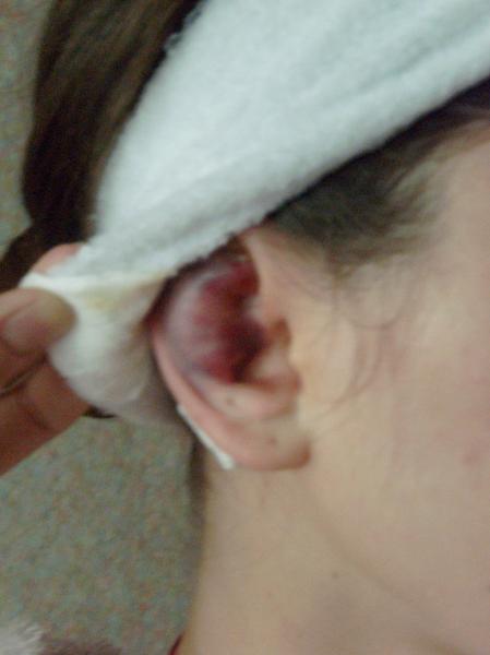 отопластика - SL747177.JPG