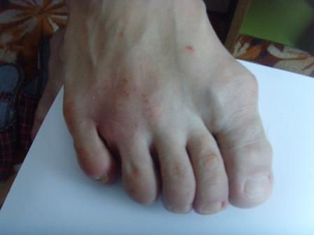 общий вид ноги - SNV34232.JPG