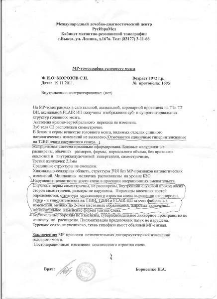 Дискуляторная энцефалопатия - Изображение.jpg