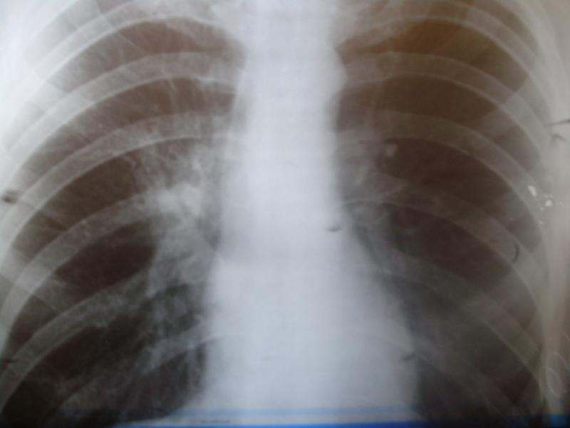 21.02.11 - 21.02.11.JPG