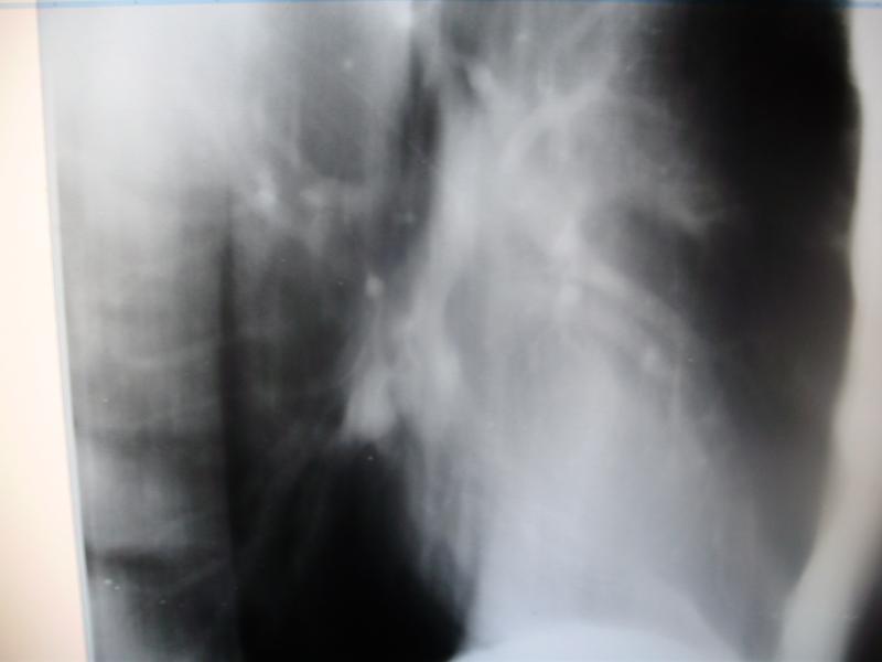 23.02.11 - 23.02.11_sboku.JPG