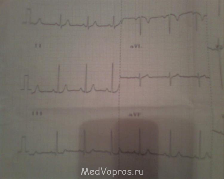 Кардиология - a7ace10f-5d0f-494f-89c4-f31b3e1f7bfc.jpg
