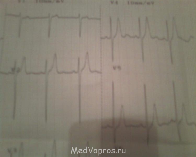 Кардиология - c115ae94-284f-4640-ade5-61bab1058e73.jpg