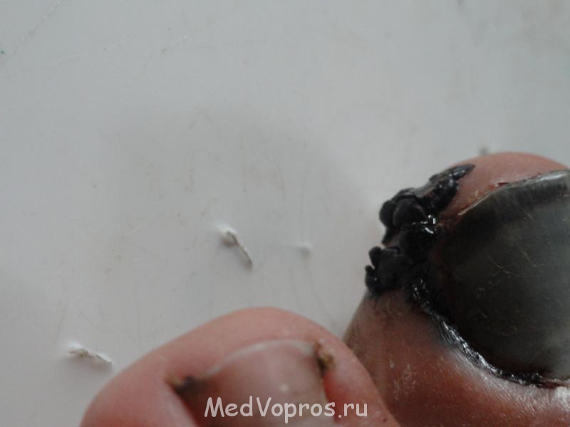 Отбил палец - DSC02717.JPG