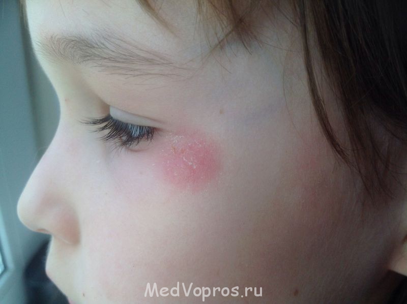 Консультация по лечению - image.jpg