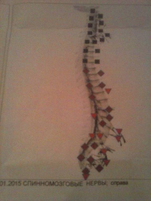 Боли в голове. Анфиография - IMG-20150123-WA0002.jpg