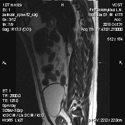 Мопс 6 лет - межпозвоночная грыжа - 10002.jpg