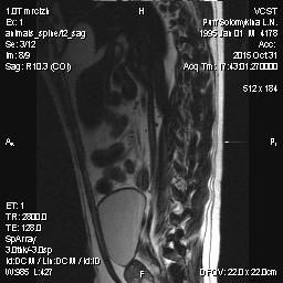 Мопс 6 лет - межпозвоночная грыжа - 10003.jpg