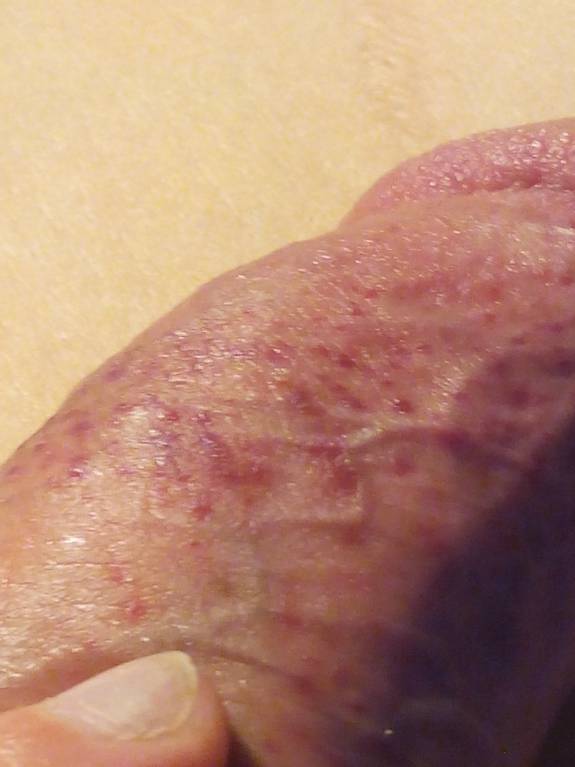 Синяк на члене ? ? ? - IMG_20160114_222451.jpg