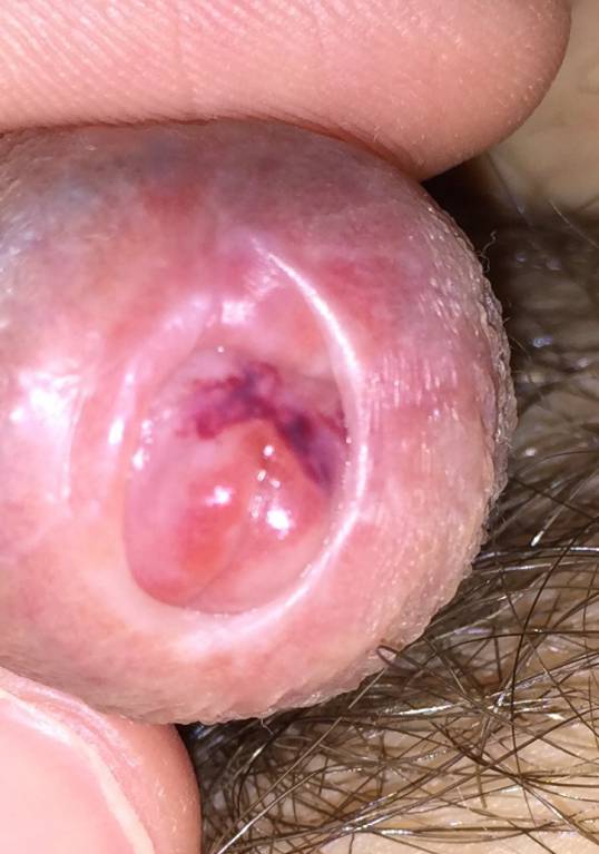 Синяк на члене ? ? ? - image.jpg