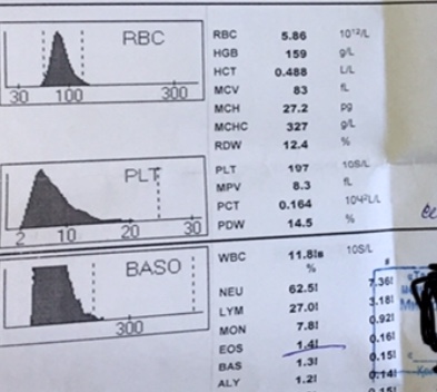 потология NRBCs, LL, LL1 - C48CE321-FD9C-4A53-97CD-9EF18E7DDC2A.jpeg