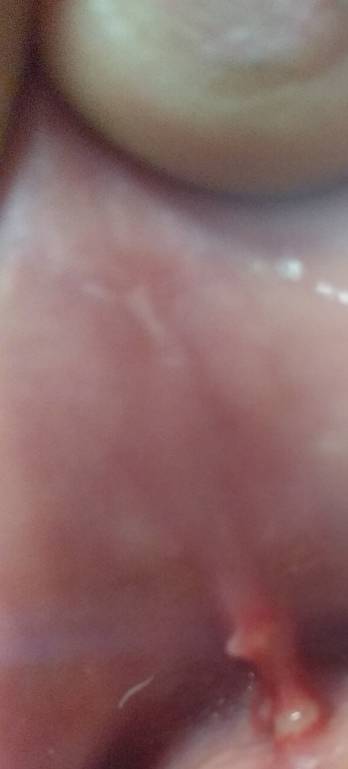 Язва или что-то похожее - IMG_20190716_202552[1].jpg