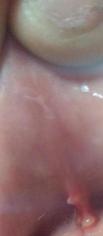 Язва или что-то похожее - IMG_20190716_202614[1].jpg