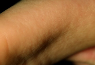 Случайно разжевал горошек черного перца, антидотировали? - IMG_2375.jpg