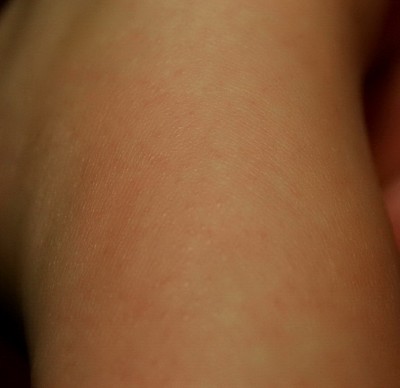 Случайно разжевал горошек черного перца, антидотировали? - IMG_2399.jpg