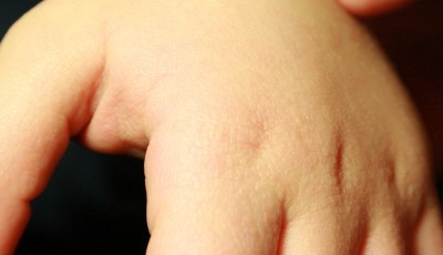 Случайно разжевал горошек черного перца, антидотировали? - IMG_2384.jpg