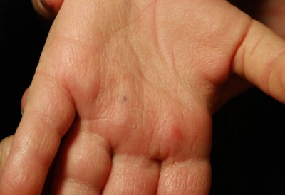 Случайно разжевал горошек черного перца, антидотировали? - IMG_2391.jpg