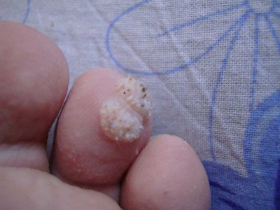 Что это за болезнь? - DSC00177.jpg