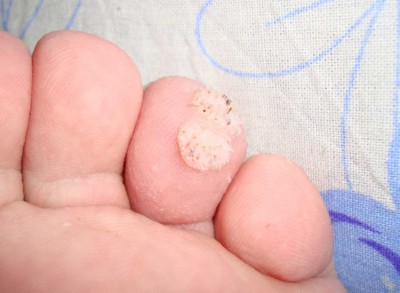 Что это за болезнь? - DSC00180.jpg