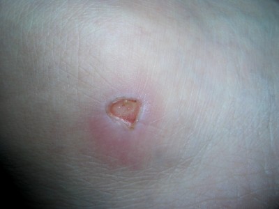 ранка на ноге - CIMG3101.JPG