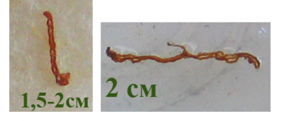 Обнаружила в стуле у ребенка фото  - это.png