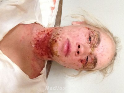 Острая ситуация - image.jpg