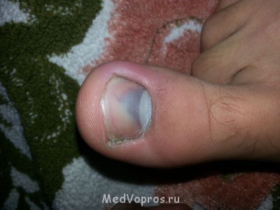 Походу ноготь отбил - 20131021_165232[2].jpg