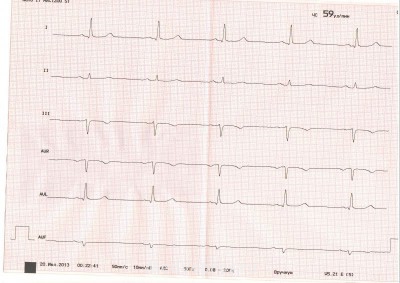 Повышенное давление, нужна помощь - Scan10007.JPG