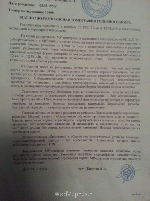 Головные боли в районе темечка - 20140112_190834.jpg