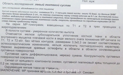 Немеет мизинец на левой руке - 1.PNG