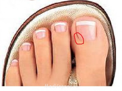 Вот конкретное место где больно при надавливании