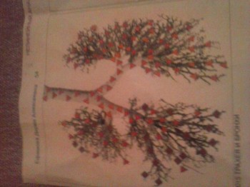 Боли в голове. Анфиография - IMG-20150123-WA0003.jpg