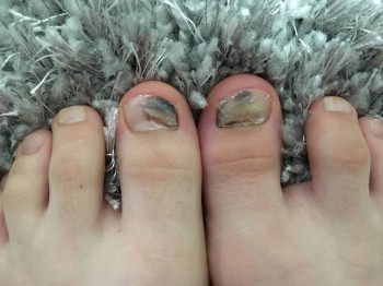 Боль на правом пальце на ногте - image.jpeg