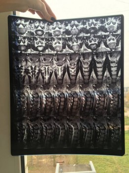 Киста шишковидной железы головного мозга - IMG_5027.JPG