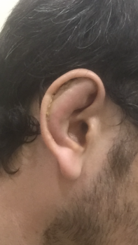 Отопластика - 7AA696E6-D0F2-4F4E-B0DD-69BF129AFD84.png