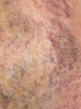 Проблемы с ногами - 4A6B302F-B9FE-4767-AD20-112C6FD1230D.jpeg