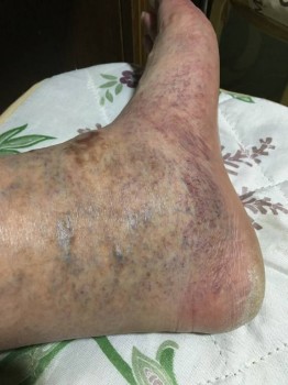 Проблемы с ногами - 9A32118B-D75F-4AC8-93CA-F0AD4DC65C4D.jpeg