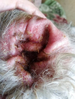 Восполение левого уха - IMG_20200511_171239.jpg