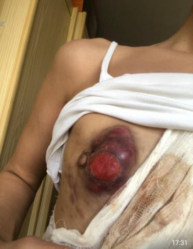 Рак груди - IMG_20210602_213804.jpg